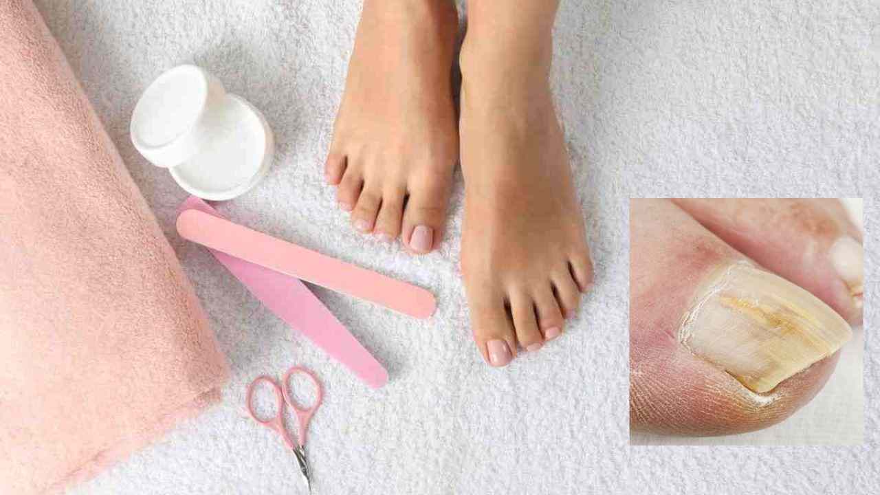 Pedicure consigli 