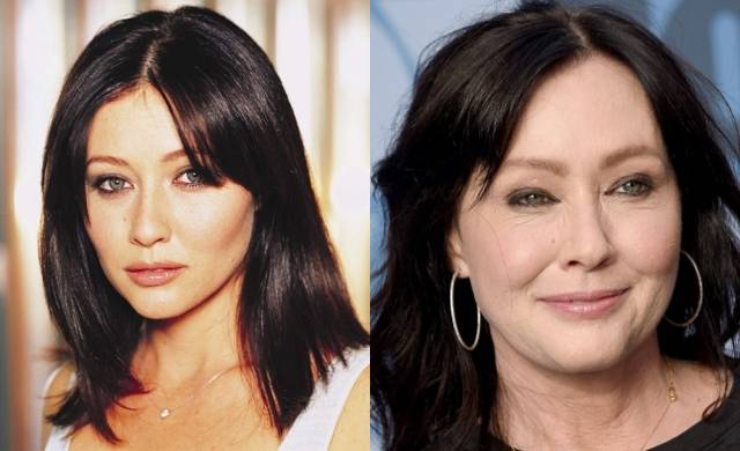 Shannen Doherty prima e dopo