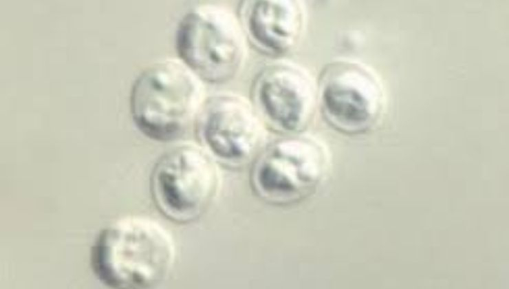 cryptosporidium